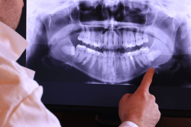 Best Emergency Dental Care for Abscessed Tooth in Salem, OR